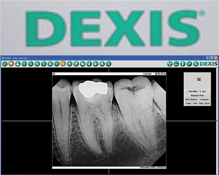 Dexis x-ray machine